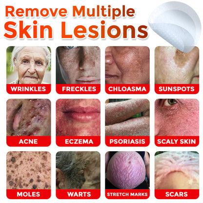 GFOUK® MicroNeedle Botanic Skin Tag Removal Patch Aligned with NHS Skincare Guidance